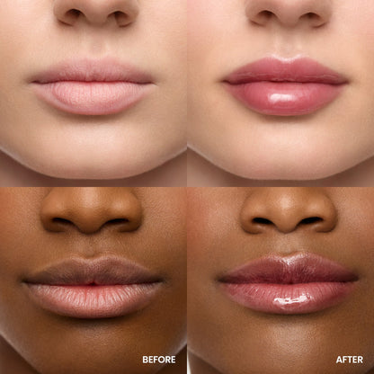 Lip Rehab Serum Oil