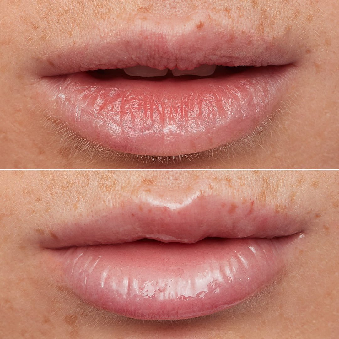lip rehab serum oil